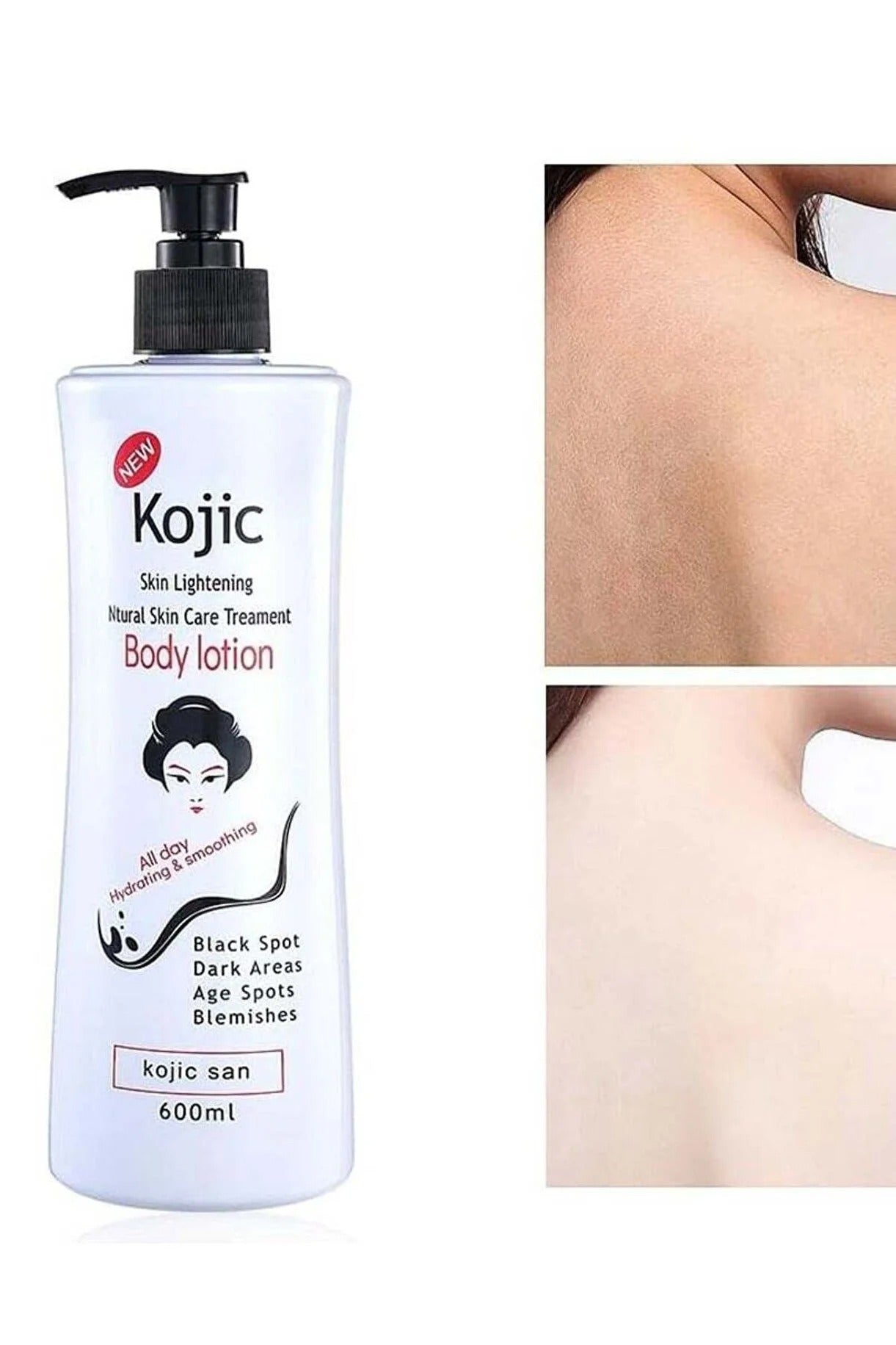 لوشن الجسم لتفتيح البشرة والعناية بها طبيعيًا من Kojie San